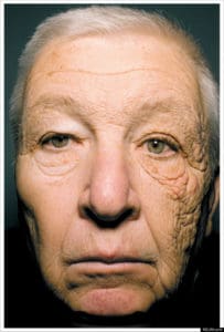 Trucker Sun Damage Image